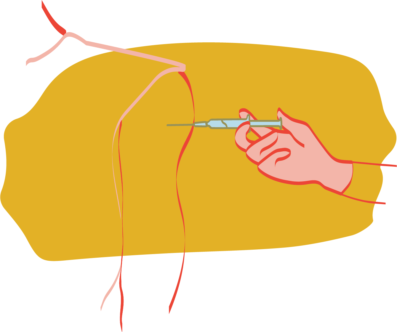 Depo Provera Injection administered by medical provider