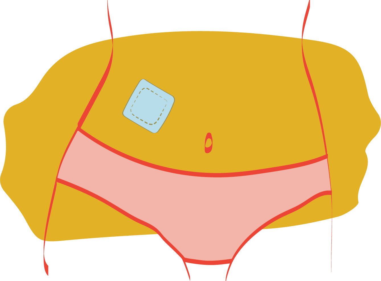 Contraceptive patch placed on the stomach